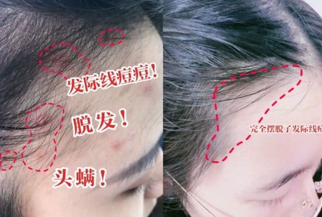 干好?10分钟轻松养成女明星「绸缎发」冰球突破游戏网站洗完头自然风干还是吹(图20) 干好?10分钟轻松养成女明星「绸缎发」冰球突破游戏网站洗完头自然风干还是吹(图20)